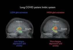 Low-Res_Covid-patient_brain-image