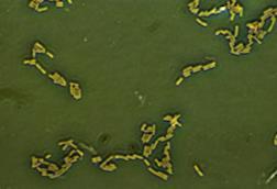 Escherichia_coli_(257_06)_Gramnegative_rods (1)