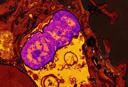 Klebsiella_pneumoniae_bacteria_with_a_human_neutrophil_(red)_containing_ingested_Klebsiella_pneumoniae_(purple)