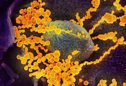 SARS-CoV-2_scanning_electron_microscope_image