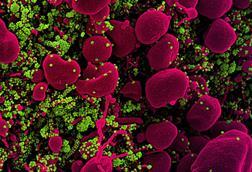 Novel_Coronavirus_SARS-CoV-2_(49919537436)