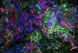 Low-Res_PM_Biofilm ©Thomas Neu UFZ