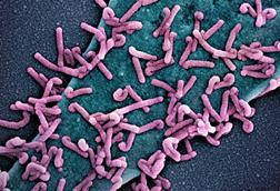 Marburg_virus_outbreak