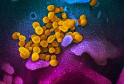 SARS-CoV-2_(yellow)