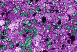 Mpox_Virus_-_53922109282