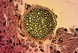 Coccidioides_fungal_spherule_found_in_a_tissue_sample_of_this_organism_that_causes_coccidioidomycosis,_also_known_as_Valley_Fever