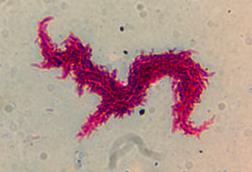 Classic_serpentine_cording_of_Mycobacterium_tuberculosis_complex_(MTBC)