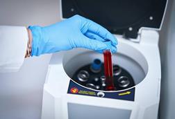 NABL_Accredited_Pathology_Lab_and_Diagnostic_Centre_in_Kharghar,_Navi_Mumbai_-_Full_Body_Checkup,_CBC,_Thyroid_Blood_Test_and_Home_Blood_Collection