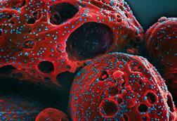 Novel_Coronavirus_SARS-CoV-2_(Omicron)_(52488777518)