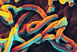 Ebola_Virus_(5)