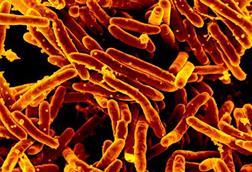 Mycobacterium_tuberculosis_MEB_(1)