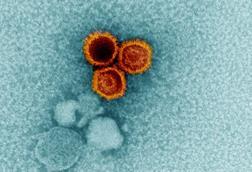 Epstein-Barr_Virus_(EBV)_Particles