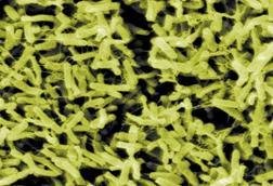 ClostridiumDifficile