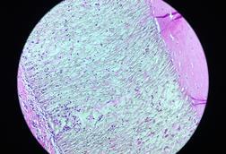 PTFE_(polytetrafluoroethylene)_-_Teflon_(49615920942)