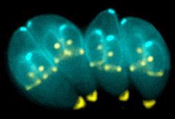 Toxoplasma_gondii