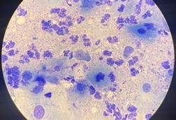 Chlamydia-22Feb25