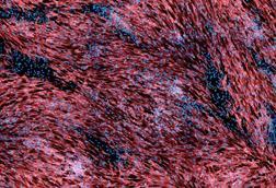 Low-Res_HF_MPXV_semen_Torbica_et_al_EmergingMicrobesInfections_2026