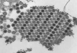 Chikungunya_virus_particles-PHIL-17369