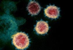 Novel_Coronavirus_SARS-CoV-2