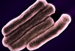 Mycobacterium_Tuberculosis_Bacteria,_the_Cause_of_TB_(52766722758)