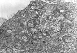 Orientia_tsutsugamushi