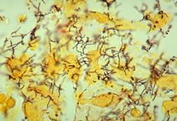 Treponema_pallidum_01