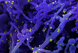 Novel_Coronavirus_SARS-Cov-2_(50010746961) (1)