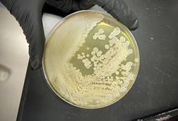 KFbacillus