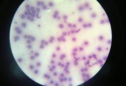 Trypanosoma_cruzi