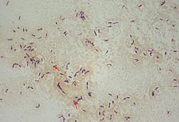 Clostridium_difficile_