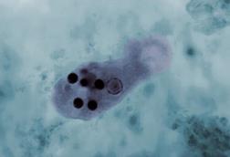 Micrograph_of_Entamoeba_histolytica