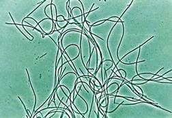 Immagine_chloroflexi_JPEG