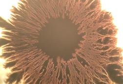 Beautiful_eye_shaped_Bacillus_subtilis_bacterial_growth_under_the_microscope_14