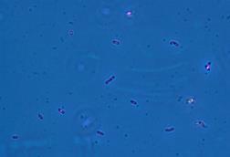 Geobacter_sulfurreducens.TIF