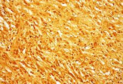 Treponema_pallidum_-_very_high_mag