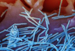 960px-Human_Respiratory_Syncytial_Virus_(RSV)_(33114415716)