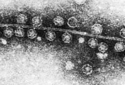 Bacteriophage_Qβ_attached_to_sex_pilus_of_E._coli