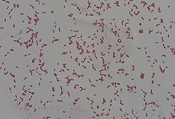 Gram_Negative_bacilli_of_Klebsiella_in_Gram_stained_smear_of_culture