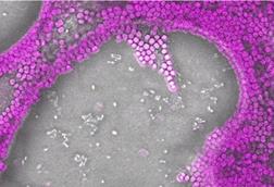 Low-Res_bacteria