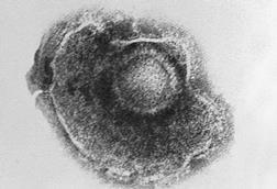 Varicella_(Chickenpox)_Virus_PHIL_1878_lores (1)