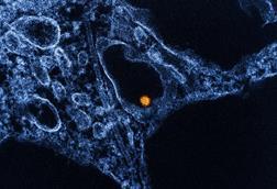 West_Nile_Virus_-_53865578133 (1)
