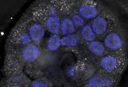 Low-Res_Microscope image of a lab-grown mini-lung showing flu virus particles (in blue) spreading across tissue