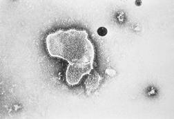 Respiratory_Syncytial_Virus_(RSV)_EM_PHIL_2175_lores
