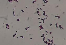 Streptococcus_agalactiae_Gram_staining_of_culture