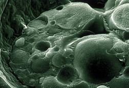 CSIRO_ScienceImage_1168_Scanning_Electron_Micrograph_of_Chytrid_Fungus