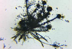 Microscope_view_of_Aspergillus_flavus_fungus_14