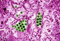 Dengue_Virus_Particles_(53231916461)