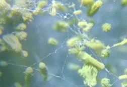 Microscope_view_of_Aspergillus_flavus_growing_on_a_leather_sample_27