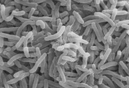 Cholera_bacteria_SEM