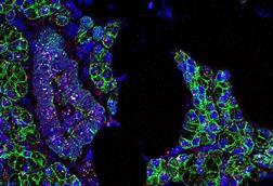 Salivary_Gland_Cells_infected_with_SARS-CoV-2_(51105883890)